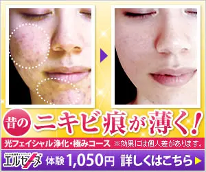 ニキビ痕が薄く！エルセーヌ